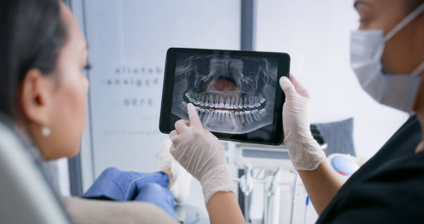 Licensed Tooth Extraction service in Akron, IA - Smile Center Dentistry